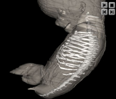 Axial Skeleton