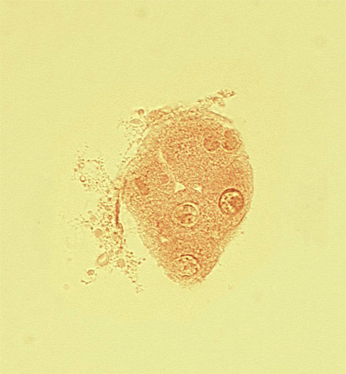 abembryonic pole, edge of disrupted zona pellucida, embryonic pole, mural trophoblast, mural trophoblast cytoplasm, mural trophoblast nucleolus, mural trophoblast nucleus