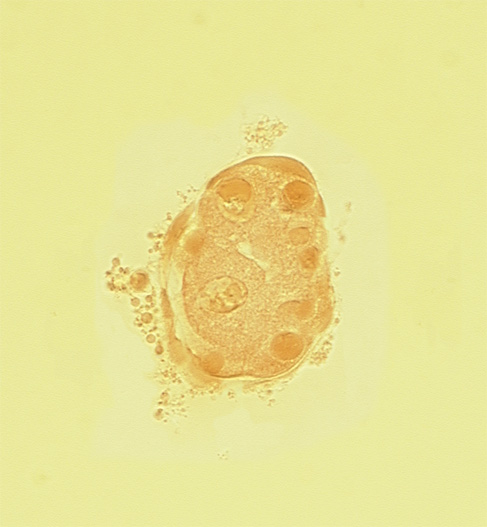 disrupted zona pellucida, edge of blastocystic cavity (blastocoele), mural trophoblast, polar trophoblast, subzonal space
