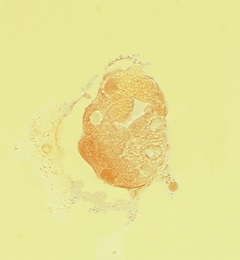 disrupted zona pellucida, edge of blastocystic cavity (blastocoele), mural trophoblast, polar trophoblast