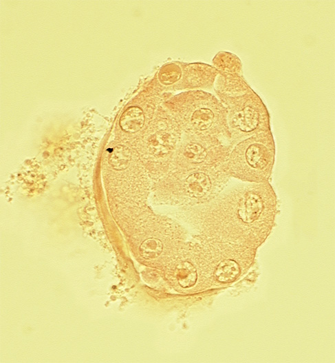 blastocystic cavity (blastocoele), disrupted zona pellucida, inner cell mass (embryoblast), mural trophoblast, polar body, polar trophoblast