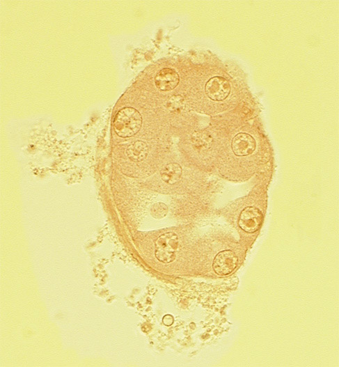 abembryonic pole, blastocystic cavity (blastocoele), disrupted zona pellucida, nucleus of embryoblast (pluriblast), nucleus of trophoblast, region devoid of zona pellucida, subzonal space