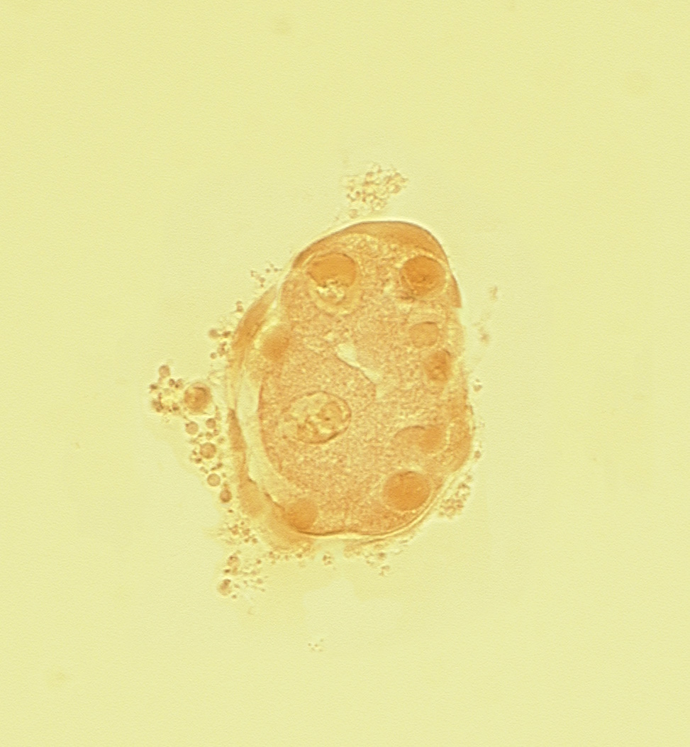 disrupted zona pellucida, edge of blastocystic cavity (blastocoele), mural trophoblast, polar trophoblast, subzonal space