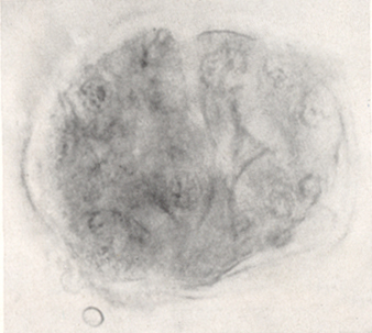 Embryo 8794