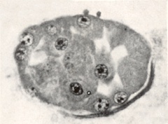 Embryo 8794