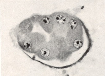 Embryo 8794