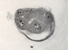 Embryo 8794