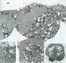 Polar trophoblast