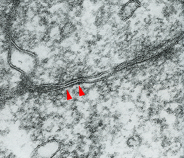 Basal tight junction between two trophoblast cells