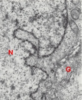 Portion of the nucleus of an epiblast cell