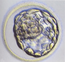 Blastocystic cavity (blastocoele) partially collapsed