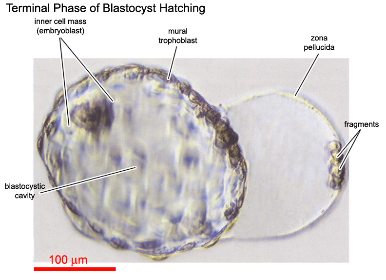 Terminal phase of hatching