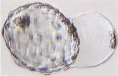 Terminal phase of hatching