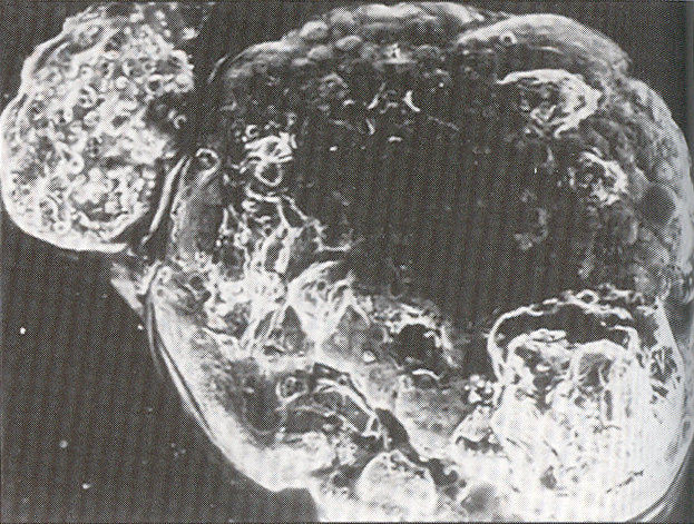 An embryo undergoing hatching