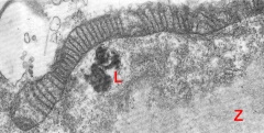 Expanding embryo showing details of a mitochondrion