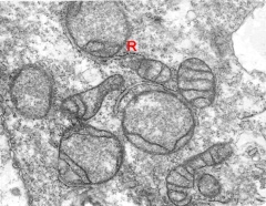 Expanded embryo showing details of mitochondria within a trophoblast cell