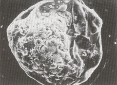 Embryo prior to hatching