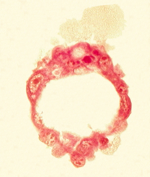 abembryonic pole, blastocystic cavity (blastocoele), edge of inner cell mass (embryoblast), embryonic pole, epiblast, hypoblast, mural trophoblast, polar trophoblast