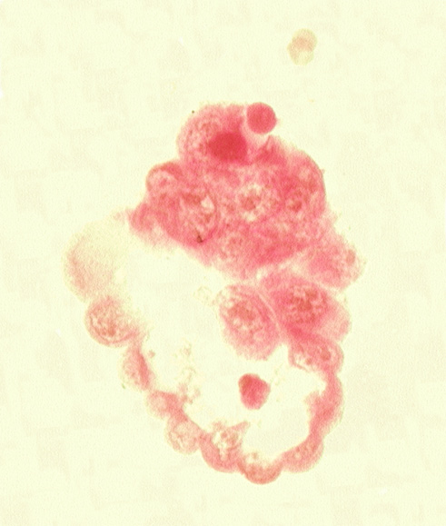 abembryonic pole, blastocystic cavity (blastocoele), embryonic pole, epiblast, hypoblast, mitotic figure(s), mural trophoblast, polar trophoblast