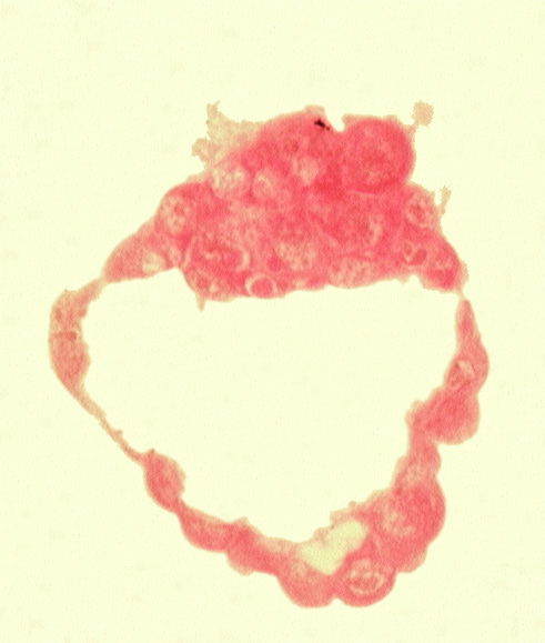 abembryonic pole, blastocystic cavity (blastocoele), embryonic pole, epiblast, hypoblast, inner cell mass (embryoblast), mural trophoblast, polar trophoblast