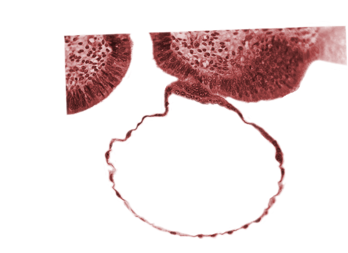 blastocystic cavity (blastocoele), contact area(s), cytotrophoblast, edematous endometrial stroma (decidua), endometrial (uterine) epithelium, mural trophoblast, syncytiotrophoblast