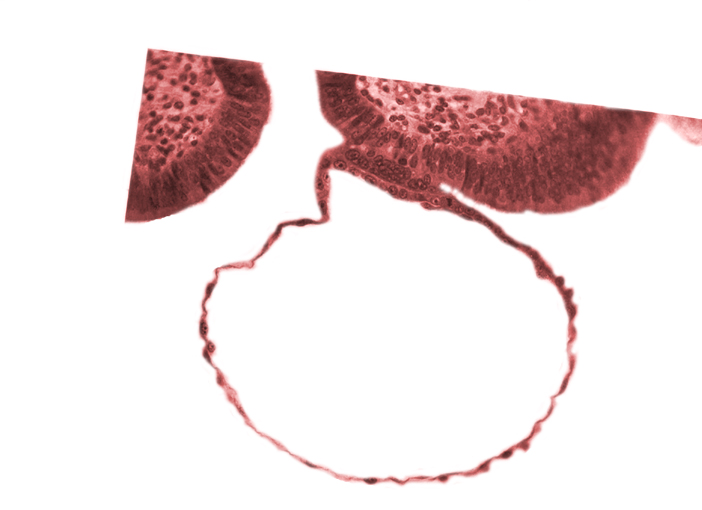 blastocystic cavity (blastocoele), contact area(s), cytotrophoblast, mural trophoblast, syncytiotrophoblast, uterine cavity