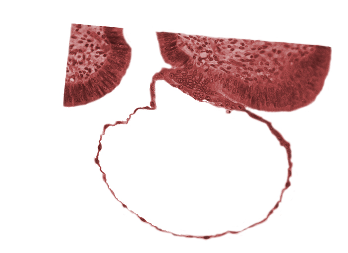 blastocystic cavity (blastocoele), cytotrophoblast, erosion of endometrial epithelium, mural trophoblast, syncytiotrophoblast
