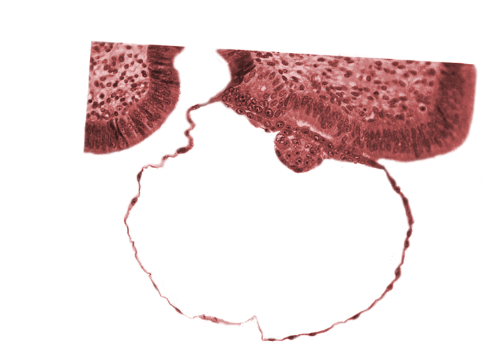 blastocystic cavity (blastocoele), contact area(s), cytotrophoblast, embryonic disc, gap in contact area, mural trophoblast, syncytiotrophoblast