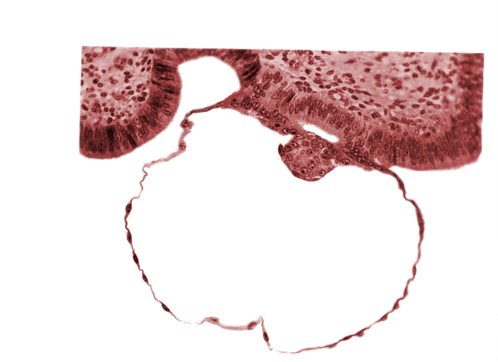 blastocystic cavity (blastocoele), epiblast, gap in contact area, hypoblast, mural trophoblast, syncytiotrophoblast