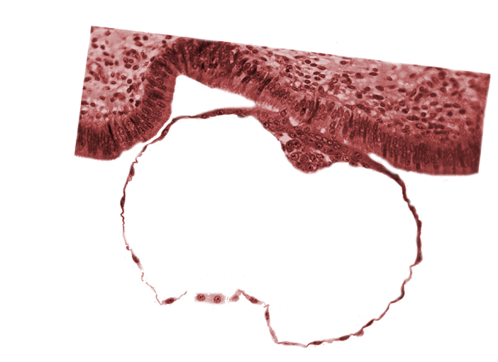 blastocystic cavity (blastocoele), embryonic disc, endometrial (uterine) epithelium, epiblast, hypoblast, mural trophoblast, primordium of amniotic cavity, syncytial-epithelial contact areas