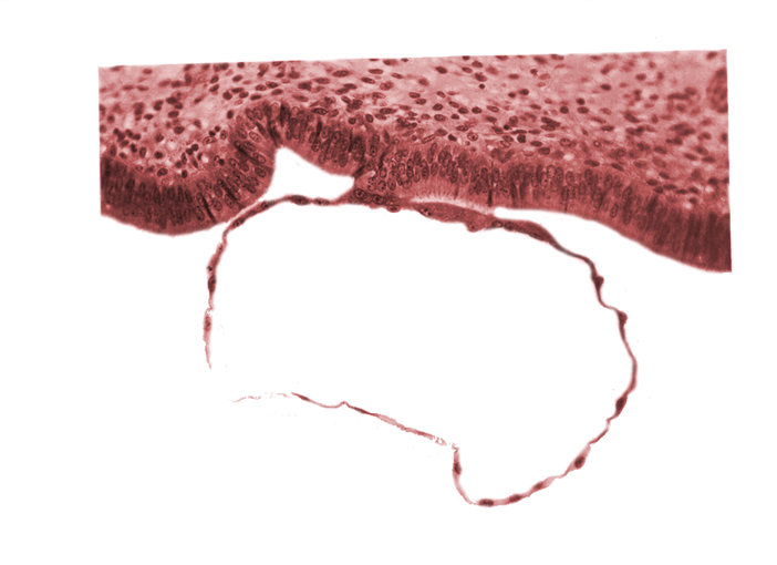 blastocystic cavity (blastocoele), contact area(s), edematous endometrial stroma (decidua), endometrial (uterine) epithelium, mural trophoblast, uterine cavity