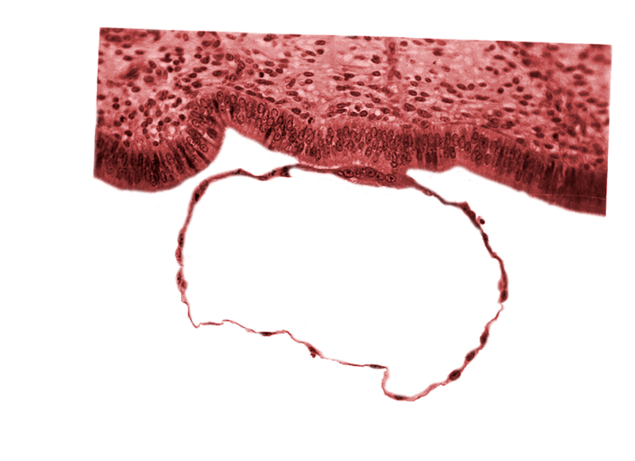 blastocystic cavity (blastocoele), contact area(s), edematous endometrial stroma (decidua), endometrial (uterine) epithelium, syncytiotrophoblast, uterine cavity