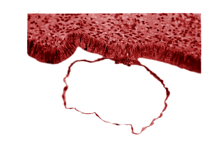 blastocystic cavity (blastocoele), cytotrophoblast, edematous endometrial stroma (decidua), mural trophoblast, syncytiotrophoblast