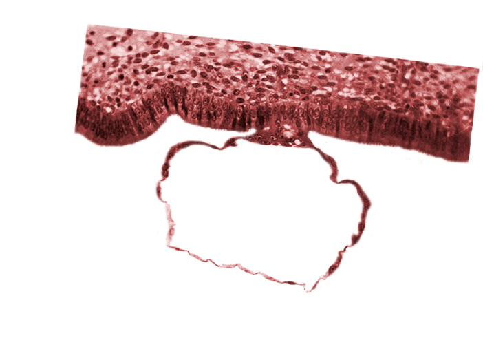 blastocystic cavity (blastocoele), contact area(s), edematous endometrial stroma (decidua), endometrial (uterine) epithelium, mural trophoblast