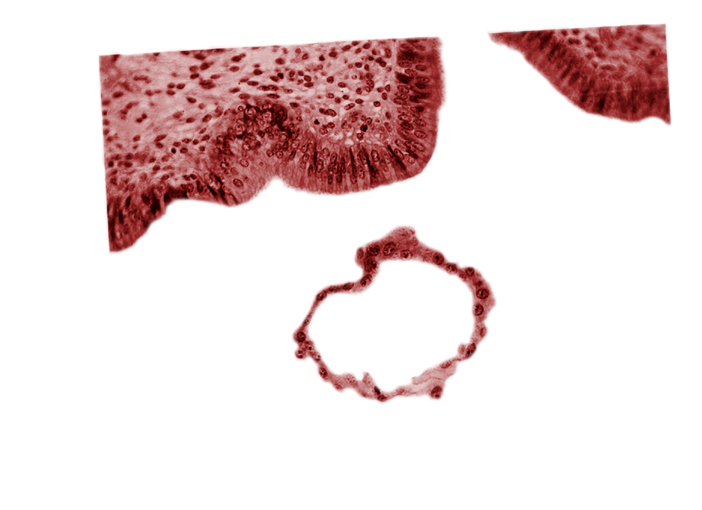 blastocystic cavity (blastocoele), tangentially cut mural trophoblast, uterine cavity