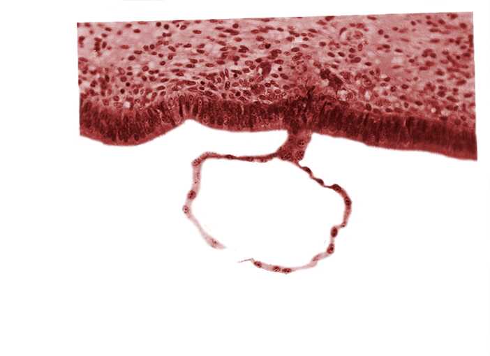 blastocystic cavity (blastocoele), edge of contact area, endometrial (uterine) epithelium, mural trophoblast, syncytiotrophoblast