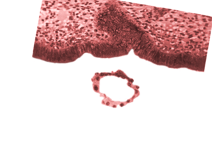 blastocystic cavity (blastocoele), endometrial (uterine) epithelium, endometrial (uterine) stroma, polar trophoblast, tangentially cut mural trophoblast