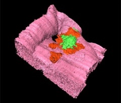 Blastocyst Attachment Site