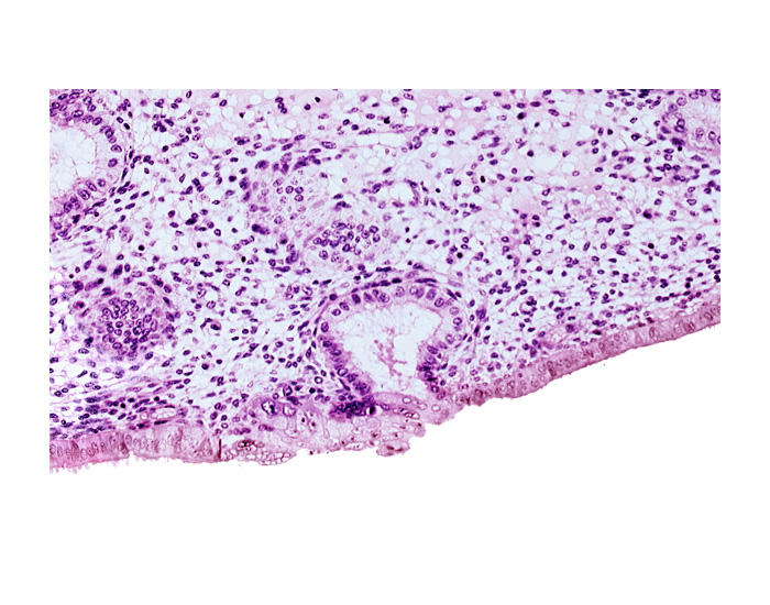 edematous endometrial stroma (decidua), endometrial epithelium, lumen of endometrial gland, solid syncytiotrophoblast