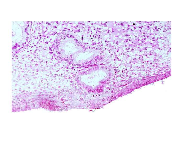 edematous endometrial stroma (decidua), endometrial epithelium, endometrial gland, solid syncytiotrophoblast, uterine cavity