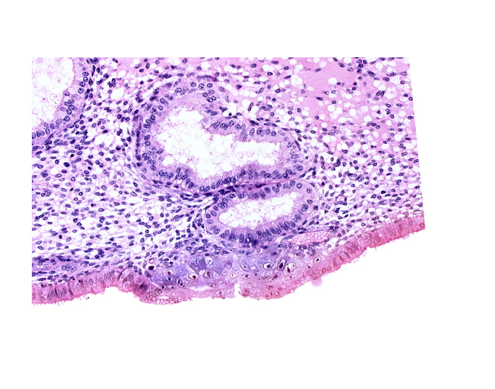 cytotrophoblast, edematous endometrial stroma (decidua), edge of blastocystic cavity (blastocoele), endometrial epithelium, endometrial gland, solid syncytiotrophoblast, uterine cavity