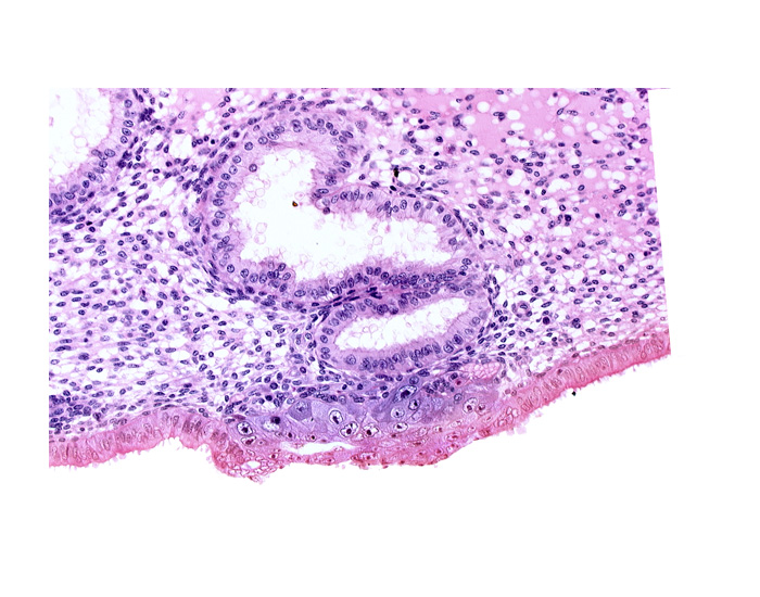 blastocystic cavity (blastocoele), cytotrophoblast, edematous endometrial stroma (decidua), extra-embryonic mesoblast, membranous trophoblast at abembryonic pole, solid syncytiotrophoblast, uterine cavity