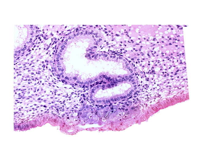 blastocystic cavity (blastocoele), cytotrophoblast, edematous endometrial stroma (decidua), endometrial epithelium, endometrial gland, extra-embryonic mesoblast, solid syncytiotrophoblast