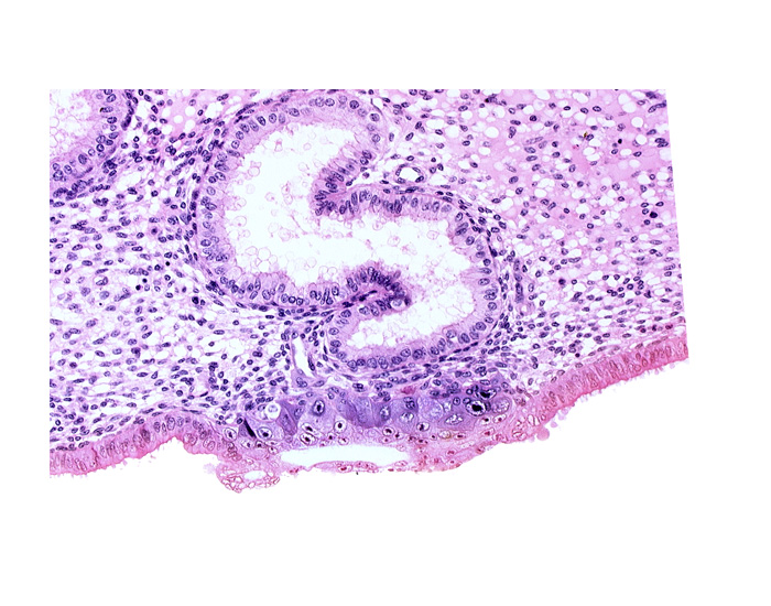 blastocystic cavity (blastocoele), cytotrophoblast, endometrial epithelium, endometrial sinusoid, extra-embryonic endoblast, lumen of endometrial gland, membranous trophoblast at abembryonic pole, solid syncytiotrophoblast, uterine cavity