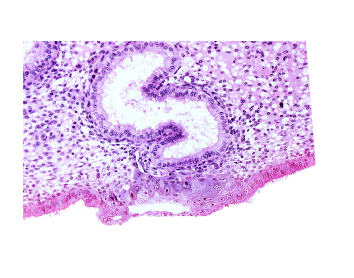 blastocystic cavity (blastocoele), cytotrophoblast, endometrial epithelium, endometrial sinusoid, lumen of endometrial gland, solid syncytiotrophoblast, trophoblast