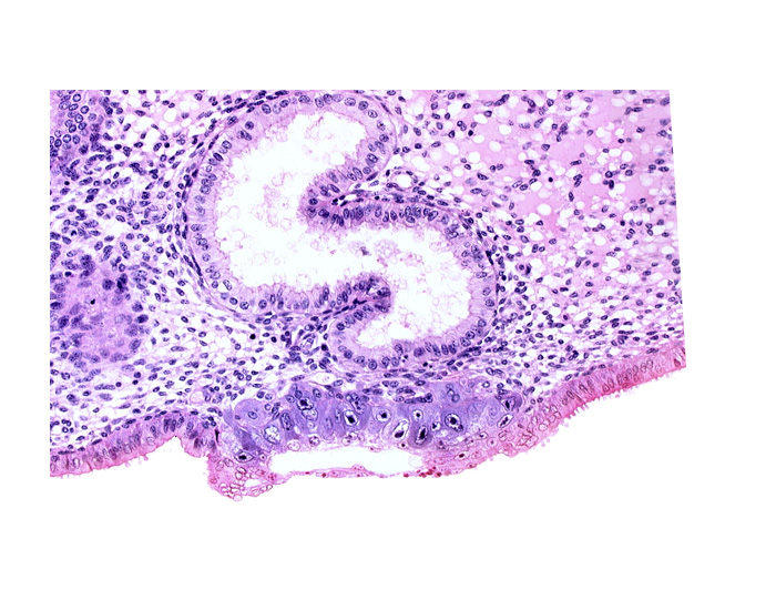 blastocystic cavity (blastocoele), endometrial epithelium, endometrial gland, endometrial sinusoid, solid syncytiotrophoblast, trophoblast