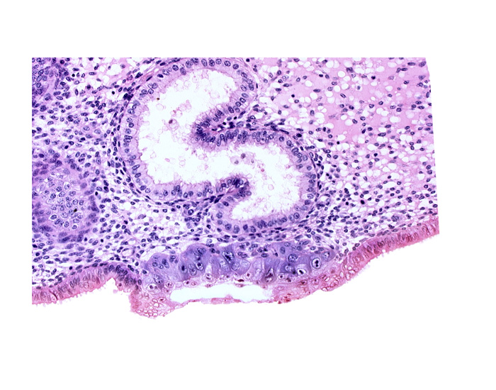 blastocystic cavity (blastocoele), cytotrophoblast, edematous endometrial stroma (decidua), extra-embryonic mesoblast, solid syncytiotrophoblast, trophoblast