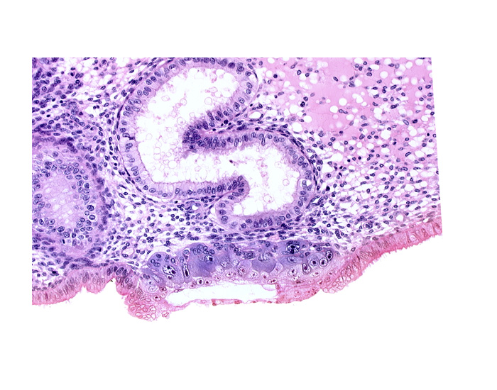 blastocystic cavity (blastocoele), cytotrophoblast, edematous endometrial stroma (decidua), endometrial epithelium, solid syncytiotrophoblast, trophoblast