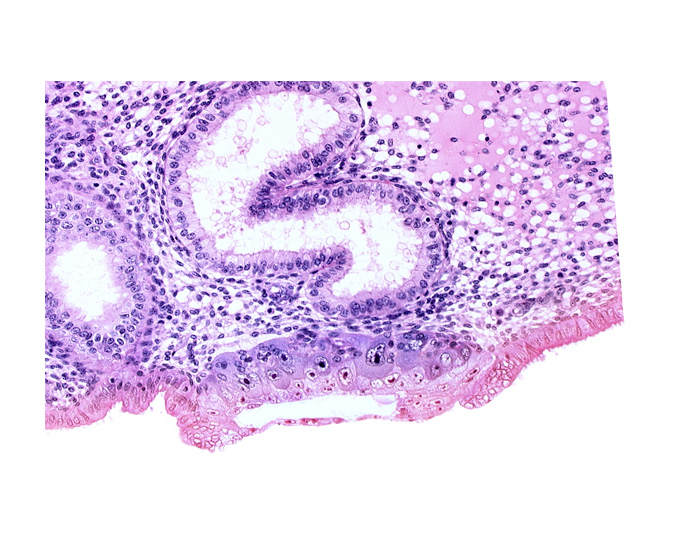 blastocystic cavity (blastocoele), endometrial epithelium, extra-embryonic mesoblast, lumen of endometrial gland, solid syncytiotrophoblast, trophoblast