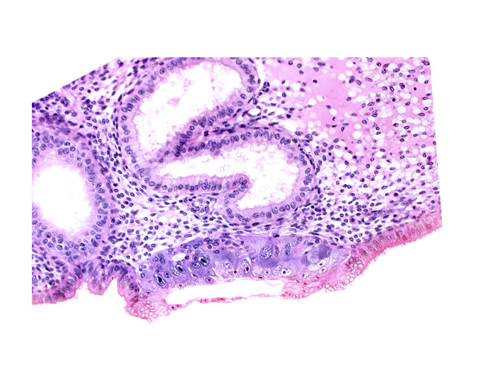 blastocystic cavity (blastocoele), cytotrophoblast, endometrial epithelium, membranous trophoblast at abembryonic pole, solid syncytiotrophoblast